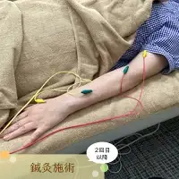 【2回目以降】鍼灸　【12203-0167】