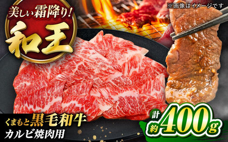 くまもと黒毛和牛 「和王」 カルビ 焼肉 用 約400g (約400g×1パック) カルビ BHBQ002