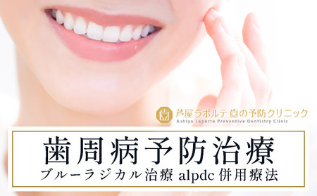 歯周病予防治療、ブルーラジカルP-01治療とalpdc併用療法（歯周病からの寛解）