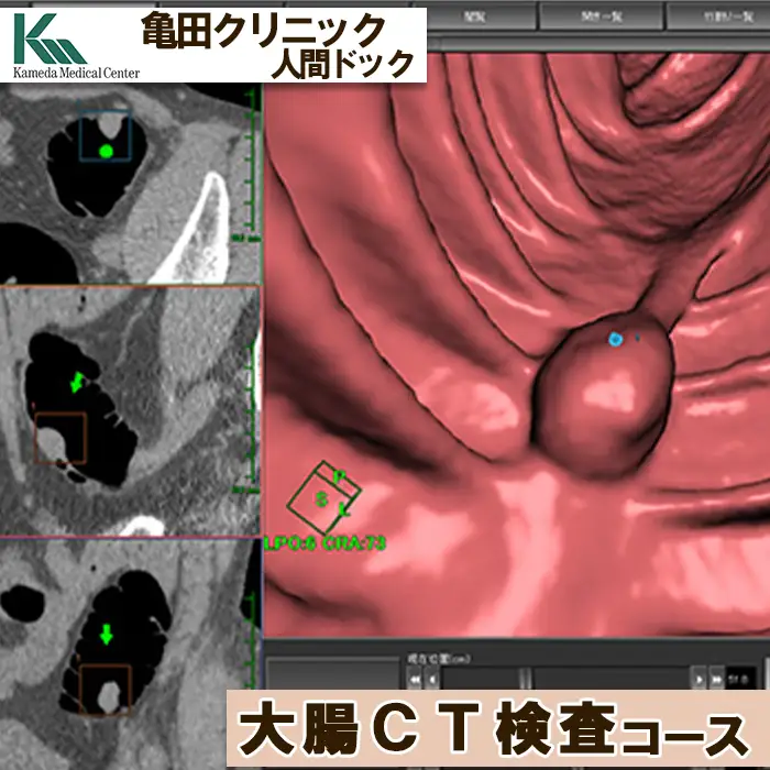 【亀田クリニック人間ドック】大腸CT検査コース　１名様（単独）　[0130-0001]