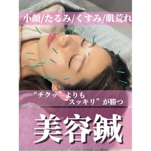 美容鍼　（１回）