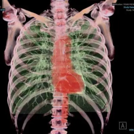 天理発  3D CT ( 頚部 ～ 骨盤 )+胆・肝・膵 MRI 健診【1737495】