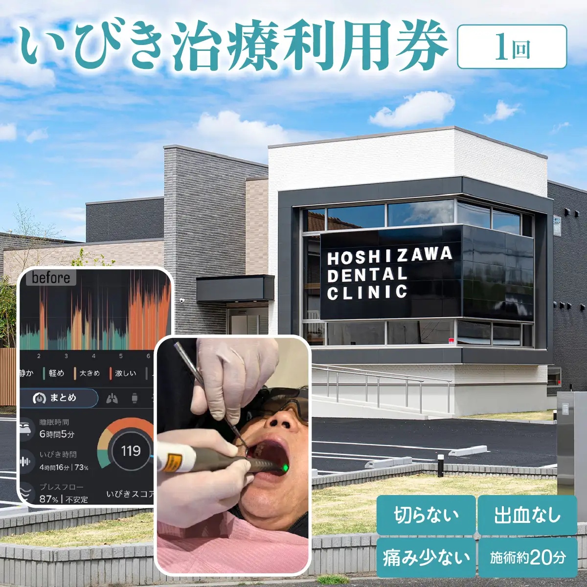 いびき治療利用券（１回） ANBV001