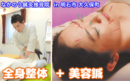 整体 全身整体 美容鍼 体験チケット 整体
