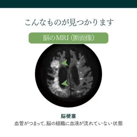 身体の健康診断を受けるなら、脳の状態も知っておいた方がいい!約20分で終わる日帰り脳ドック!_旅行券・チケット   _【1450274】