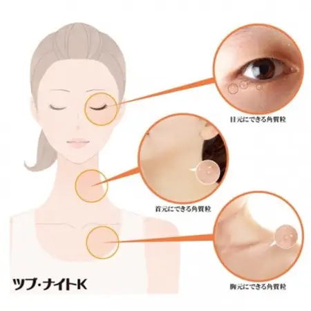 ツブ・ナイトK クリーム 100g　目元などにできるポツポツ(角質粒)のスキンケアに!_美容  スキンケア _【1536064】