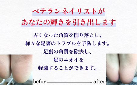 足裏 角質取り 体験 チケット 角質 ケア 足 予防 ニオイ 軽減 ネイリスト ネイルサロン