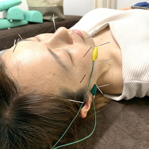 MOHALA鍼灸院美容施術体験チケット（美容鍼等のフェイシャル施術 50分） ※北海道・沖縄・離島への配送不可