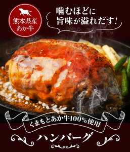 GI認証取得 くまもとあか牛100％使用 くまもとあか牛ハンバーグ 150g×20パック あか牛 ハンバーグ 牛肉 肉 国産 九州産 熊本県産 冷凍《30日以内に出荷(土日祝除く)》