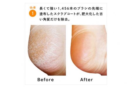 フットグルーマーグラン　スターホワイト