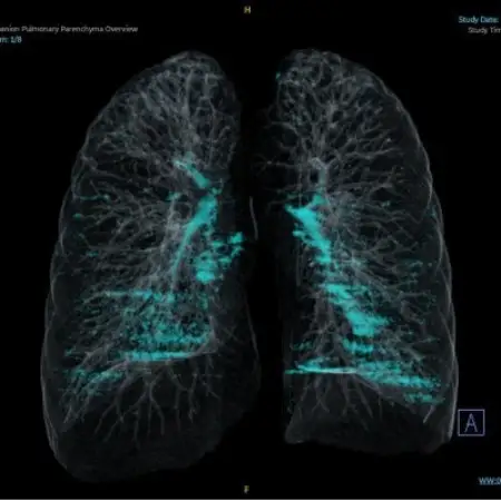 天理発  3D CT ( 頚部 ～ 骨盤 )+胆・肝・膵 MRI 健診【1737495】