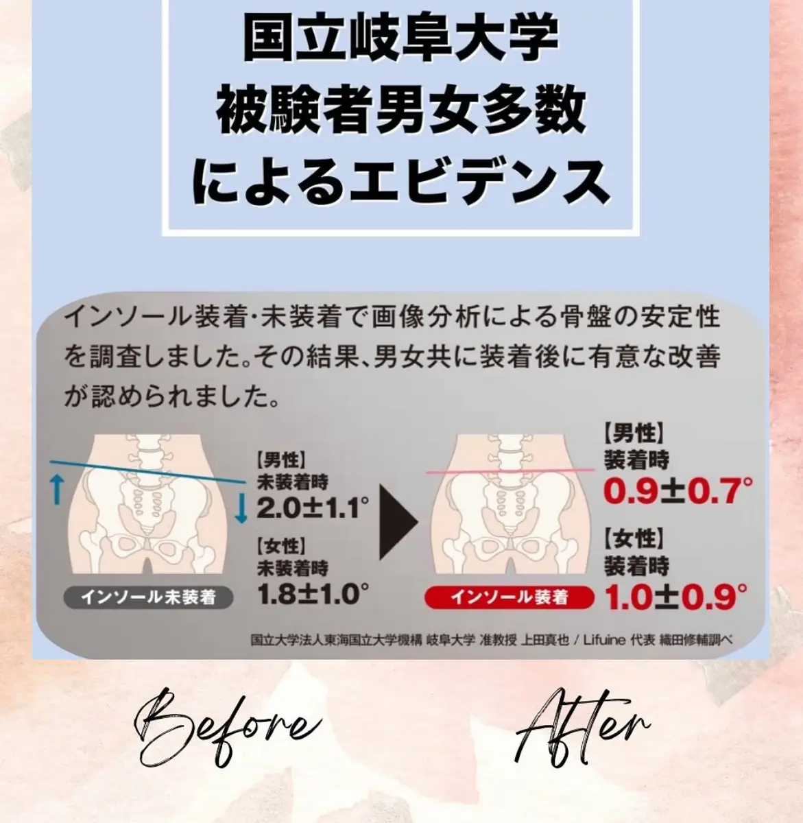 ５本指インソール ブラック XS (湯煎用 トレー付き)