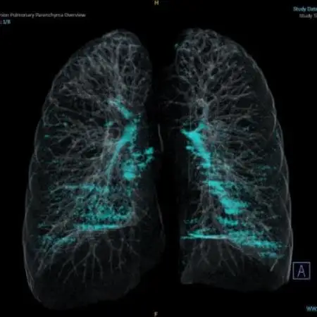 「天理発　3D　CT　画像健診」【1737492】