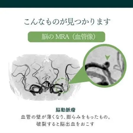 身体の健康診断を受けるなら、脳の状態も知っておいた方がいい!約20分で終わる日帰り脳ドック!_旅行券・チケット   _【1450274】