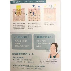 コラーゲン活性☆彡光フォトフェイシャル体験チケット
