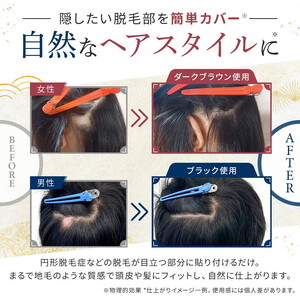 今すぐなんとかしたい円形脱毛症に、気になる部分に貼るだけ「QAMOJIヘアパッチ」　自分の髪に自然となじむ高品質人工毛、毎日交換テープで衛生的、第三者機関によりパッチテスト済！　※離島への配送不可