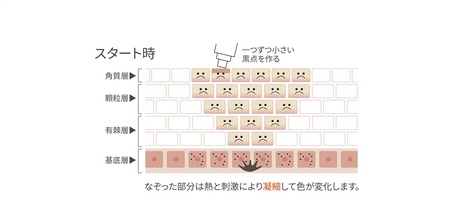 リアージュ（シミケア）30分コース 5回券 フェイシャルコース クレンジング 角質ケア マスク ヘッドマッサージ 低周波パルス チケット 5回分 セット プライベートサロン Bodycare Salon MYSA 山梨県 北杜市 [h252]