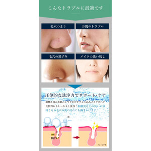 アクアビュルジェネレータ　インライン３　AQUA BULLE