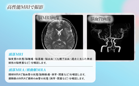 脳ドック プラチナチケット | 人間ドック MRI 検査