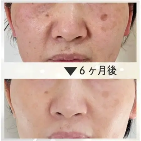 【女性限定】結果にこだわった28年の綺麗になるエステコース(フェイシャルorボディ)【1572890】