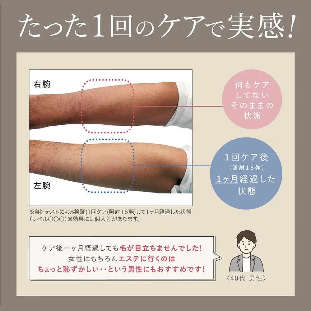 LINKA エピゼロ（IPL光脱毛器）