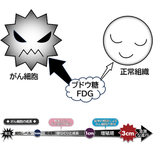 日本医科大学千葉北総病院 PET／CT 健康診断 [0490]