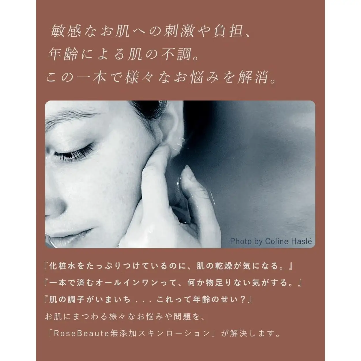 ロサブラン RoseBeaute【ヒト幹細胞エクソソーム&ナイアシンアミド配合】 無添加ノンケミカルスキンエッセンスローション 120ml 日本製
