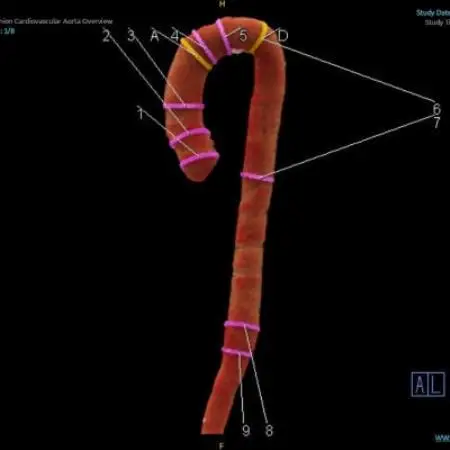 「天理発　3D　CT　画像健診」【1737492】