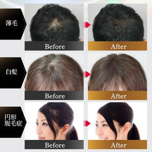 N/H ヘアファンデーション 白髪隠し 薄毛隠し ｜ 簡単 早い 自然な仕上がり 肌にやさしい スカルプ パウダー ポンポン 薄毛 白髪染め 男性 女性 生え際 根元 分け目 円形脱毛症 ボリュームアップ ブラック ブラウン 黒 茶 日本製