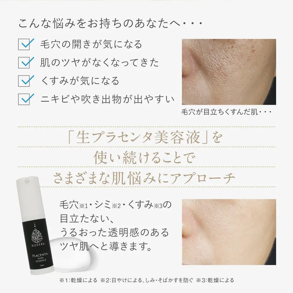 【ロゼべ】生プラセンタ 美容液 |京都 コスメ 美容液 人気 おすすめ