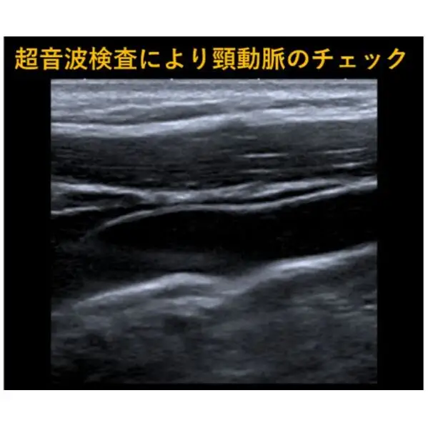 簡易脳ドック受診券1名分 脳ドック 利用 クーポン券 健康診断 チケット 人間ドック 浜松PET診断センター 検診 MR検査 超音波検査 血液検査 静岡 浜松市