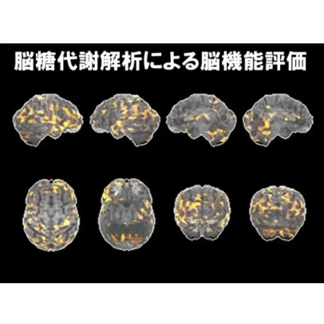 PET認知症検診／FDGコース受診券1名分 PET認知症 FDG 利用 クーポン券 健康診断 チケット 人間ドック 浜松PET診断センター 検診 FDG-PET検査 脳糖代謝解析 認知機能評価 静岡 浜松市