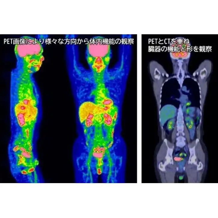 PETがん検診/PET-CTコース受診券1名分 PET PET-CT がん検診 利用 クーポン券 健康診断 チケット 人間ドック 浜松PET診断センター 検診 PET検査 静岡 浜松市