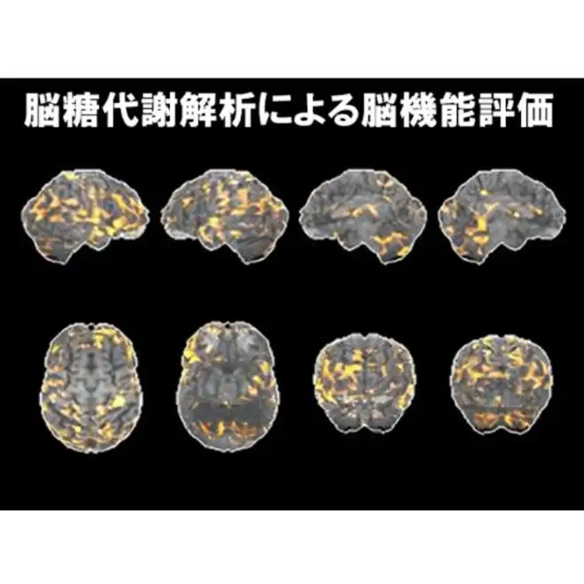 PETがん検診/総合コース+脳オプション受診券1名分 がん PET 脳 利用 クーポン券 健康診断 チケット 人間ドック 浜松PET診断センター 検診 PET CT MRI 超音波 画像診断 MRA検査 神経心理テスト 脳糖代謝解析 静岡 浜松市