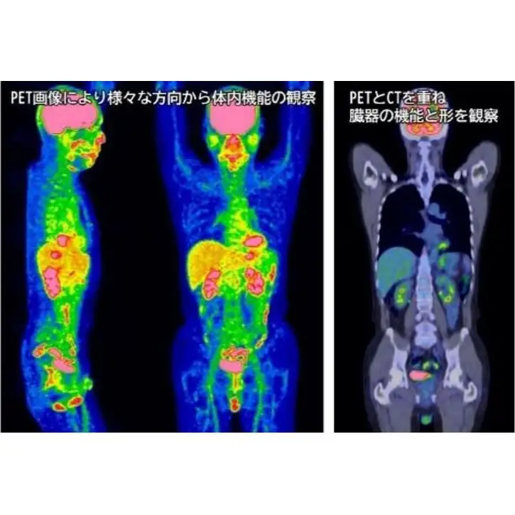PETがん検診/総合コース受診券1名分 PET がん 利用 クーポン券 健康診断 チケット 人間ドック 浜松PET診断センター 検診 CT MRI 超音波 画像診断 静岡 浜松市