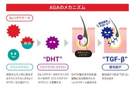 測定 AGA 薄毛リスク 髪の毛数本でわかる！【毛髪ホルモン量測定キット（DHT）】