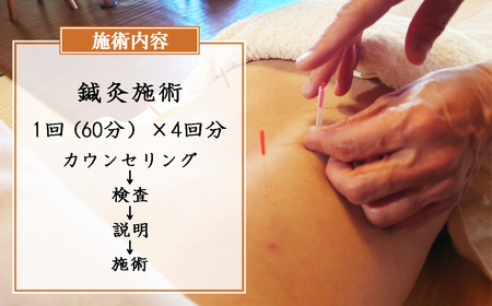 コンフォート鍼灸院施術　「クラシカルコンフォート」4回分チケット