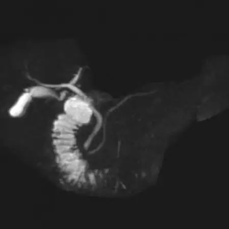 天理発  3D CT ( 頚部 ～ 骨盤 )+胆・肝・膵 MRI 健診【1737495】
