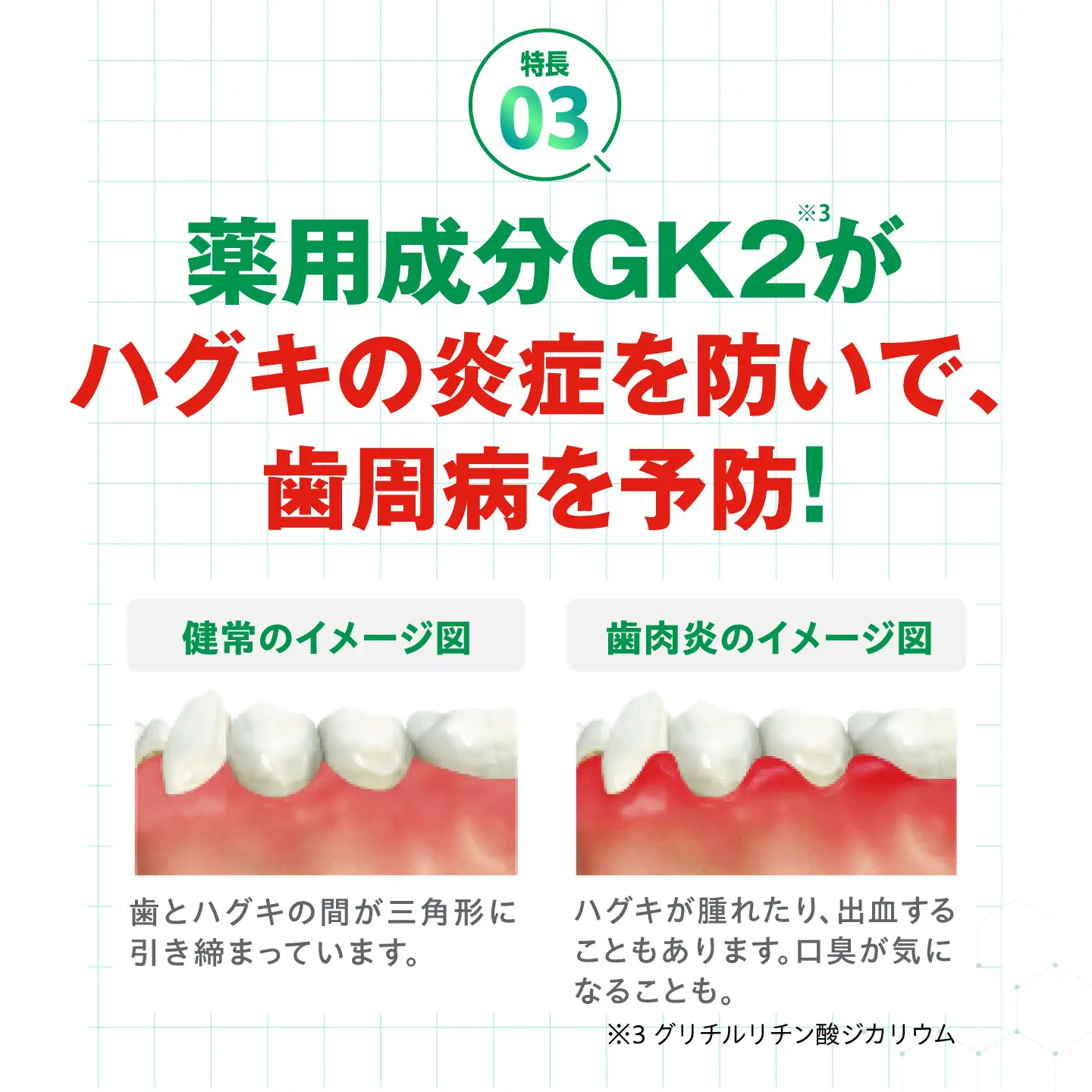 GUM デンタルペースト(ST) 120g×24本 大阪府高槻市/サンスター[AOAD078]