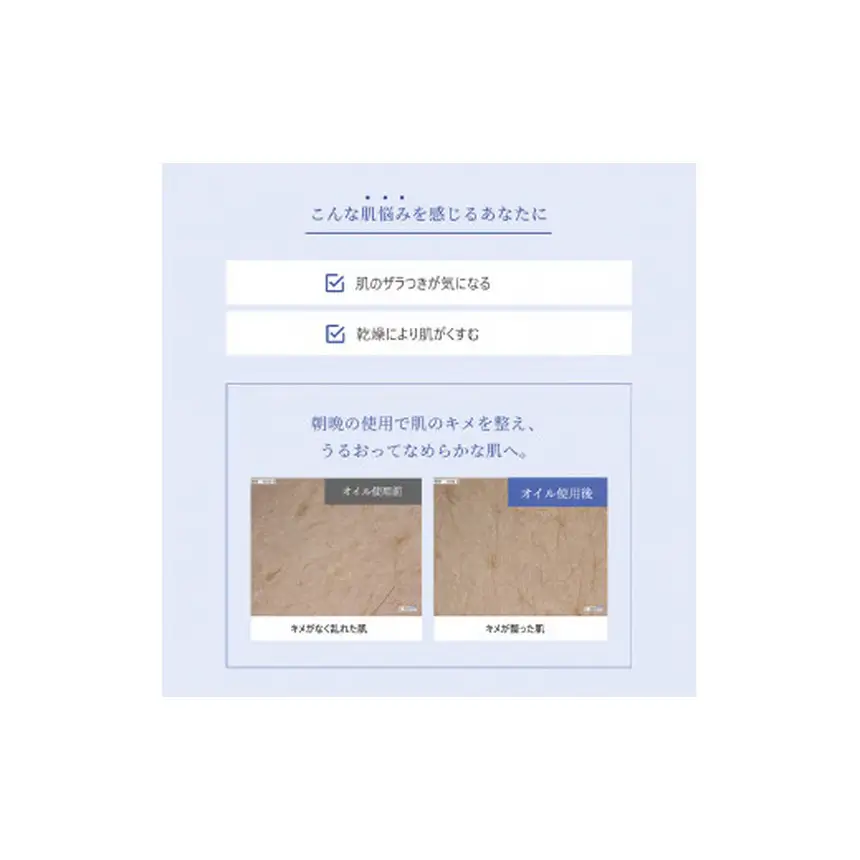 [10-I8]チャントアチャーム ピールケアオイル a ｜30ml 美容液 角質ケア 自然由来成分100% ウッディハーブの香り