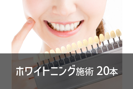 ホワイトニング20 （内容量1回）
