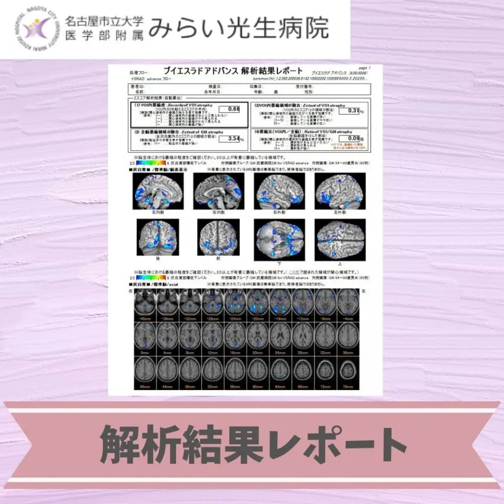 みらい光生病院　Well being(ウェルビーイング)　検診　脳メモリードック
