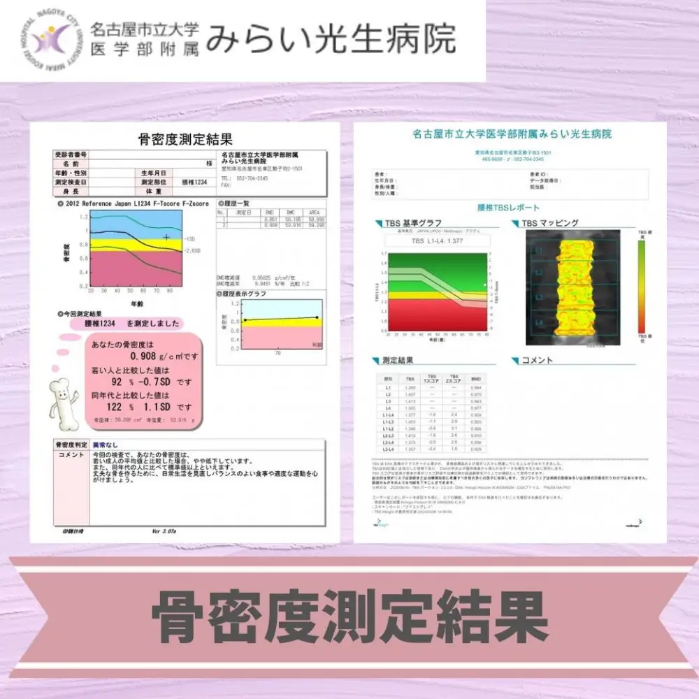 みらい光生病院　Well being（ウェルビーイング）検診　骨・ロコモドック