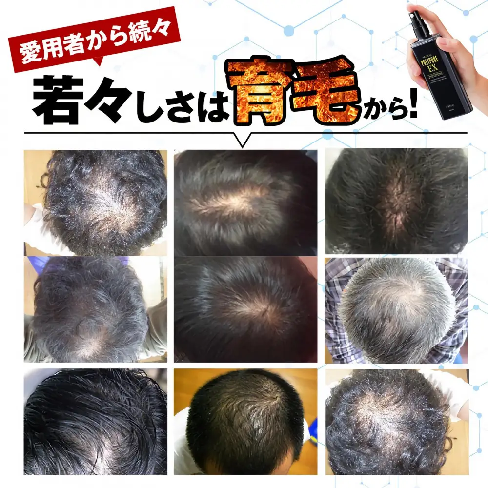 ポリピュアEX 120ml × 5本セット 医薬部外品 薬用 育毛剤 男性用 女性用 育毛 発毛 促進 薄毛 抜け毛予防