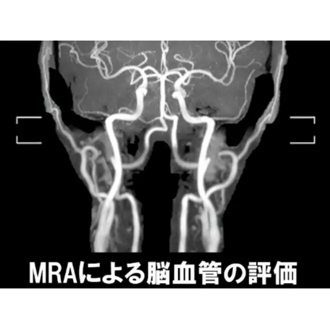 PETがん検診/総合コース+脳オプション受診券1名分 がん PET 脳 利用 クーポン券 健康診断 チケット 人間ドック 浜松PET診断センター 検診 PET CT MRI 超音波 画像診断 MRA検査 神経心理テスト 脳糖代謝解析 静岡 浜松市