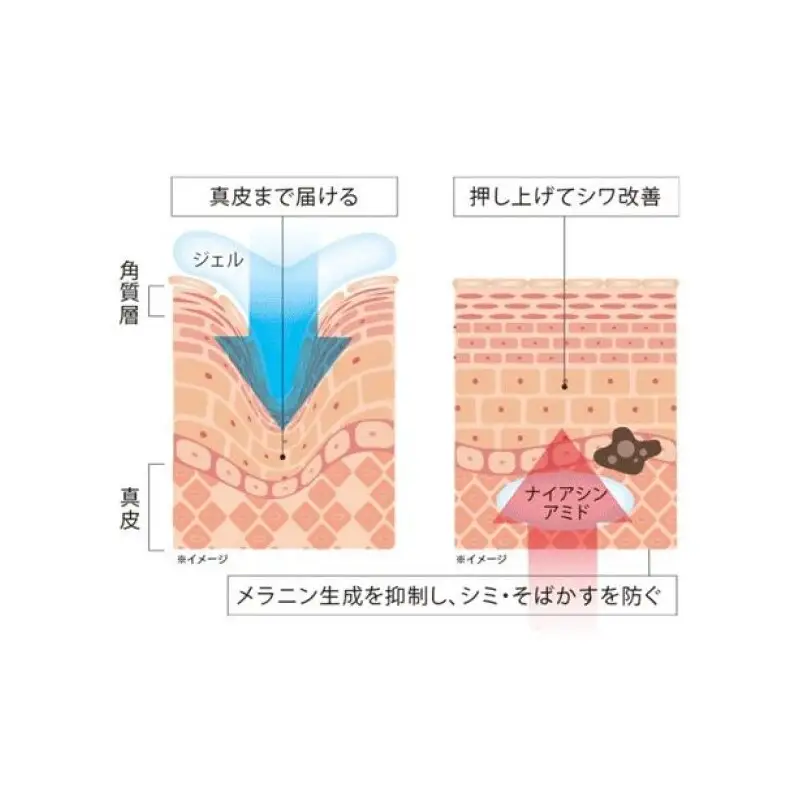 定期便 6ヶ月 日本第一製薬 アルジュール薬用ホワイトリンクルジェル 美容 ※配送不可：沖縄県、離島