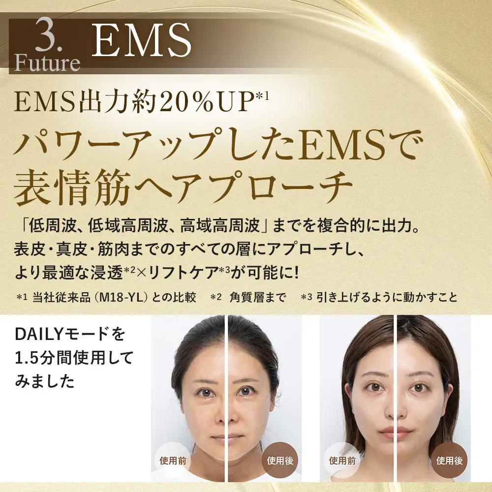 【ヤーマン】フォトプラス シャイニー ネオ 美顔器 RF美顔器 ヤーマン 美容家電 美容 スキンケア 光美容器 連射 光 美肌光 エステ 透明感 化粧ノリUP トリプルRF 毛穴ケア くすみケア ユヤ感 うるおいUP ハリUP フェイス セルフケア 美肌 ハリ ほうれい線 プレゼント ギフト 贈り物 鳥取県 鳥取市