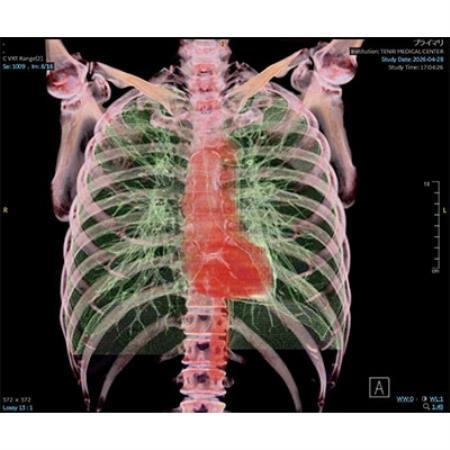 「天理発 3D CT 画像健診」