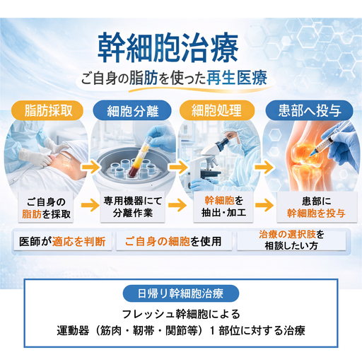 [日帰り幹細胞治療]フレッシュ幹細胞による運動器(筋肉・靭帯・関節等)1部位に対する治療(※本返礼品は、院長診察にて本治療が適応と診断された方のみご利用いただけます。)
