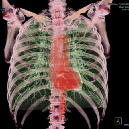 天理発 3D CT ( 頚部 〜 骨盤 )+胆・肝・膵 MRI 健診